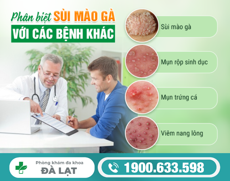 Hình ảnh minh họa